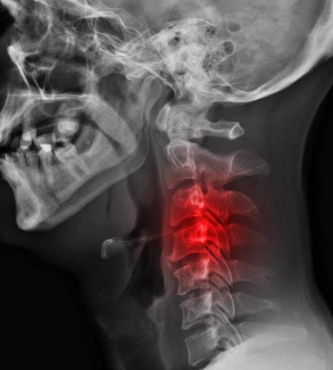 Xray _red.jpg